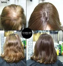 Karkafi Hair