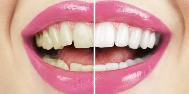 Al Sham Dental Clinic